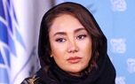 چهره قبل و بعد عمل بهاره افشاری لو رفت / عکسی که نباید ببینید!